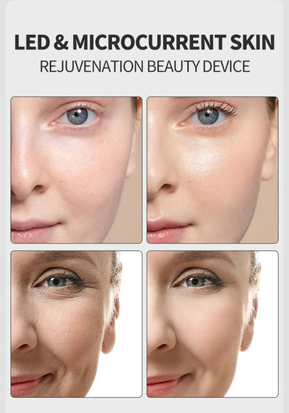 Masajeador Facial de microcorriente EMS Profesional